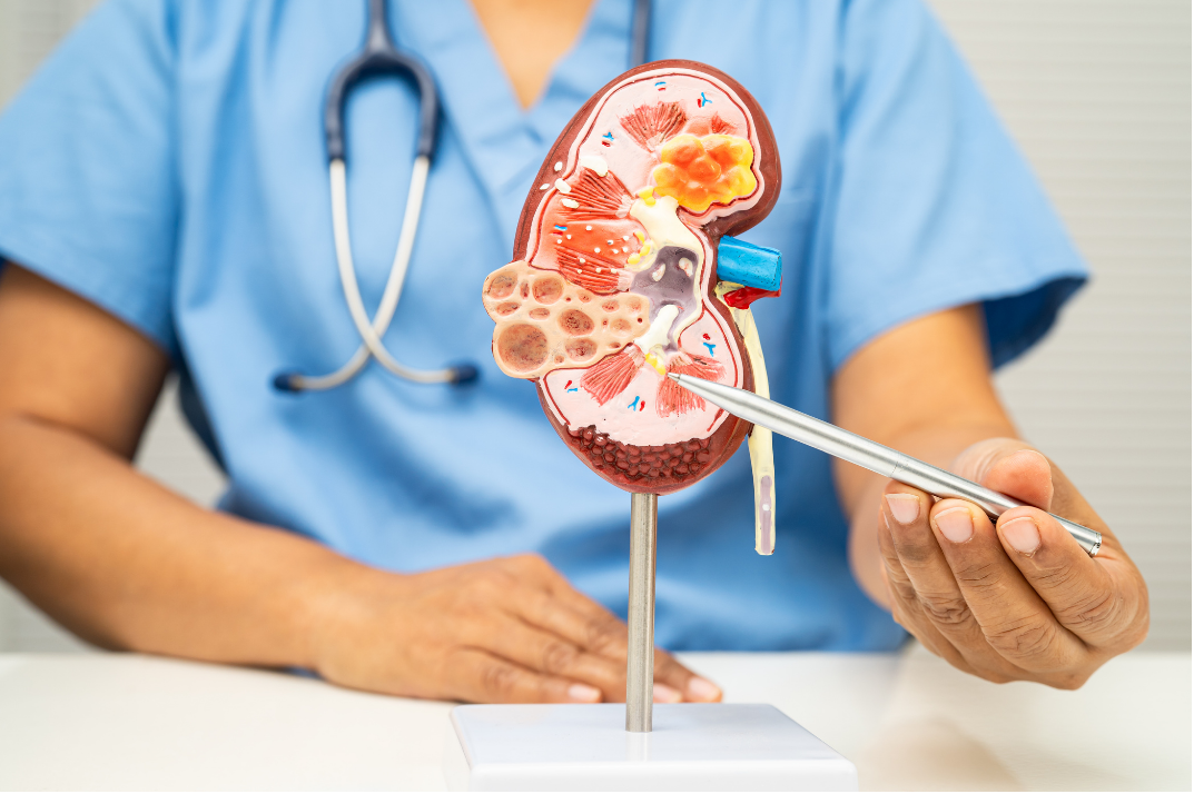 Chronic Kidney Disease