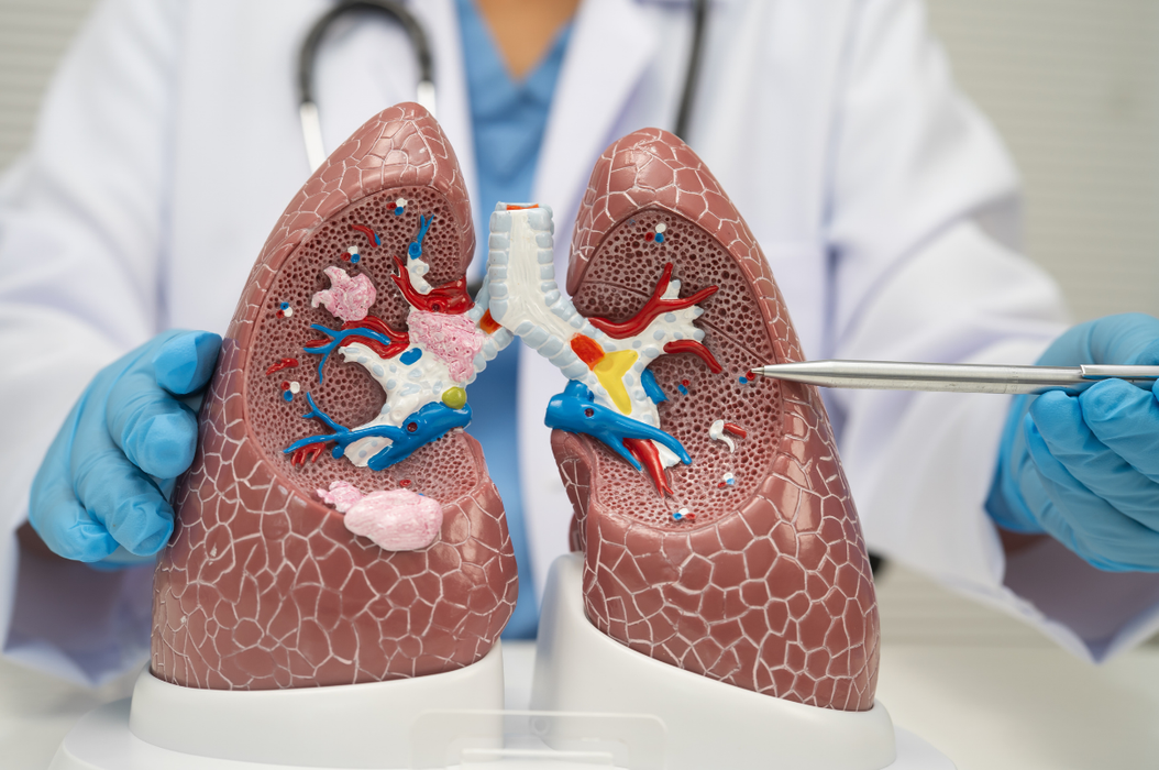 Pulmonary Fibrosis 